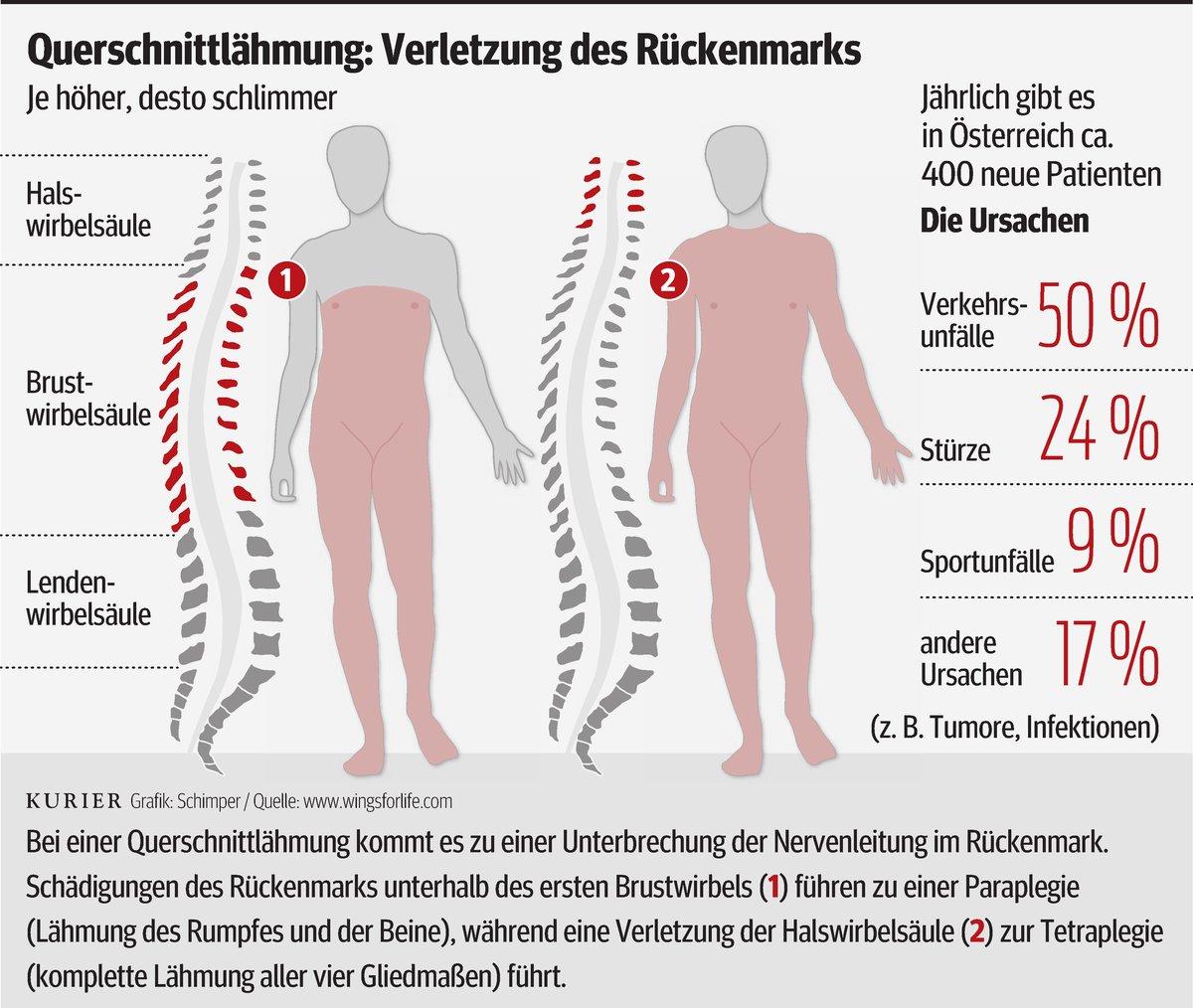 Was heißt inkomplette Querschnittlähmung