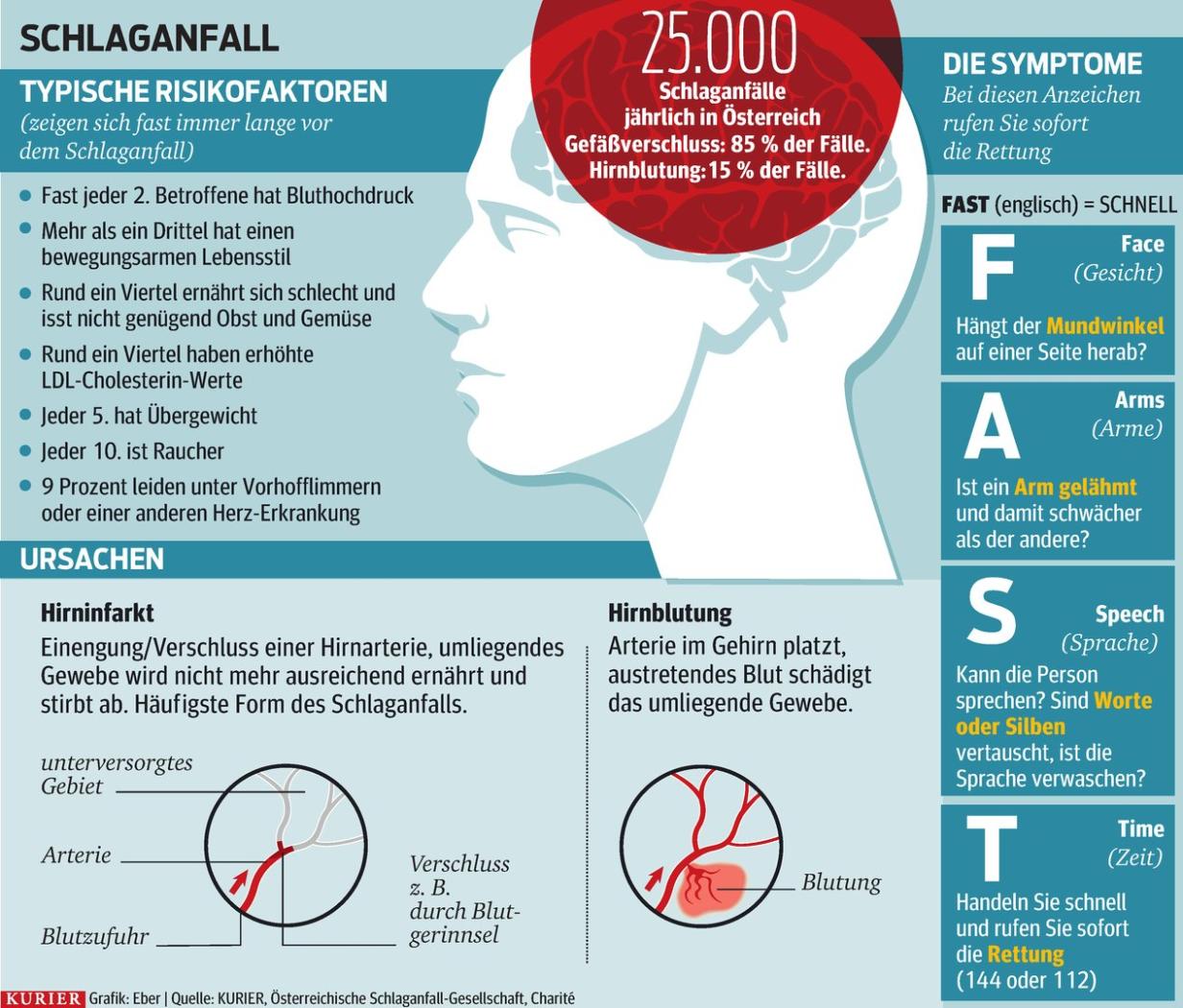 Schlaganfall trifft auch Jüngere