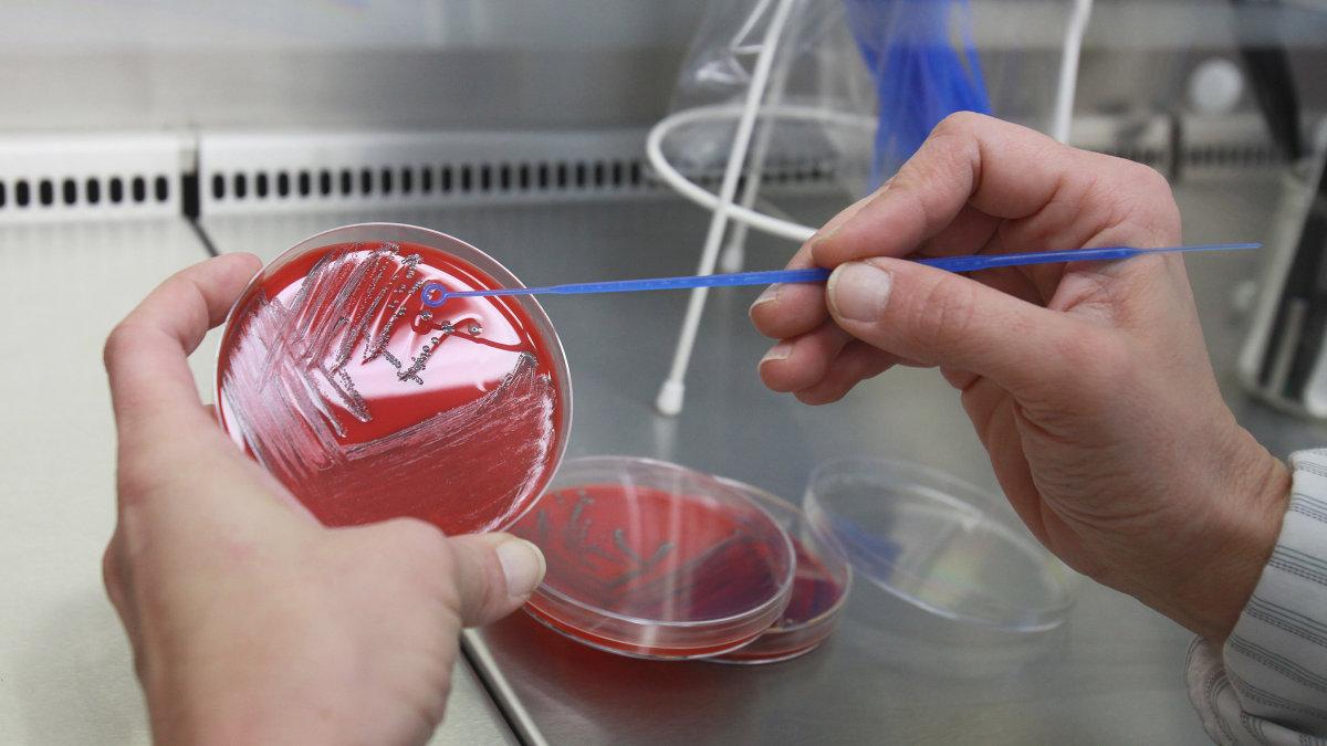 Wie man sich vor Listerien schützt