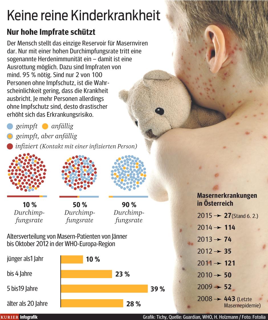 Was Sie über Masern wissen müssen | kurier.at