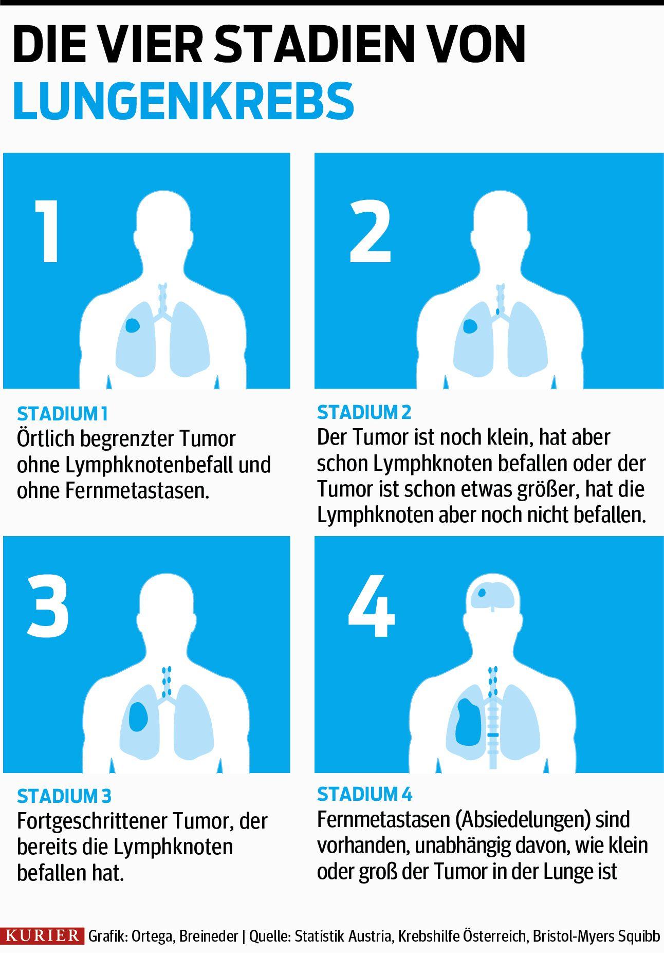 Lungenkrebs: Größere Überlebenschancen Dank Neuer Therapien