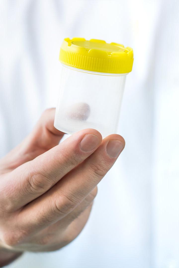 Eine Hand hält einen leeren, durchsichtigen Kunststoffbehälter mit gelbem Deckel.