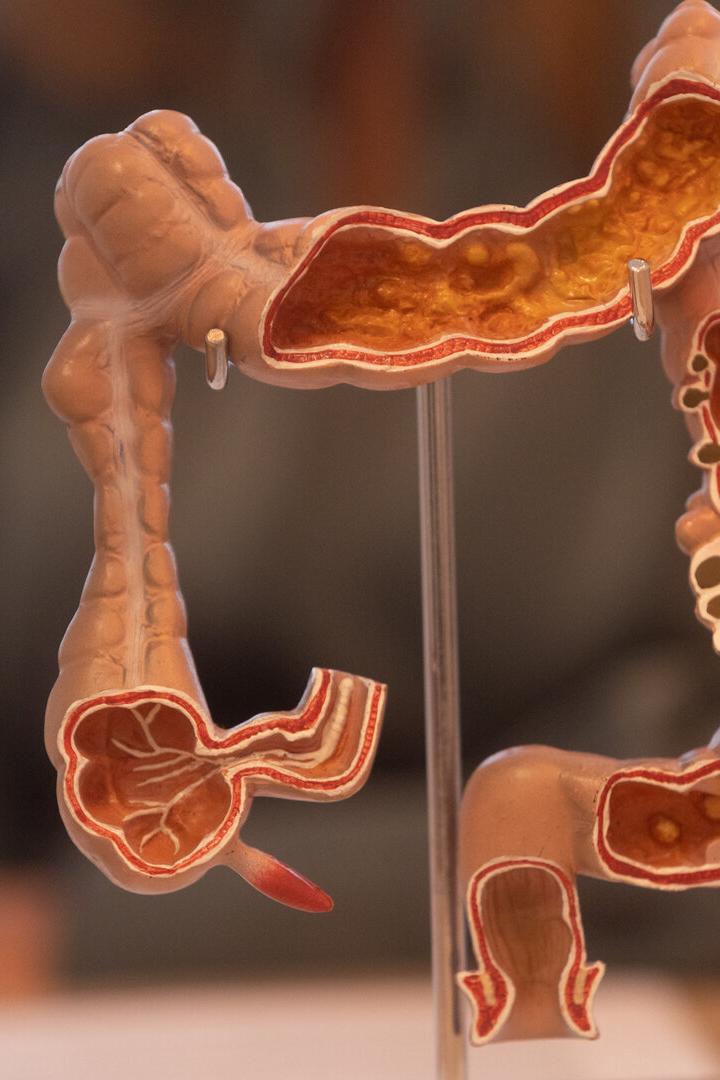 Ein anatomisches Modell eines menschlichen Dickdarms mit sichtbarem Querschnitt und inneren Strukturen.