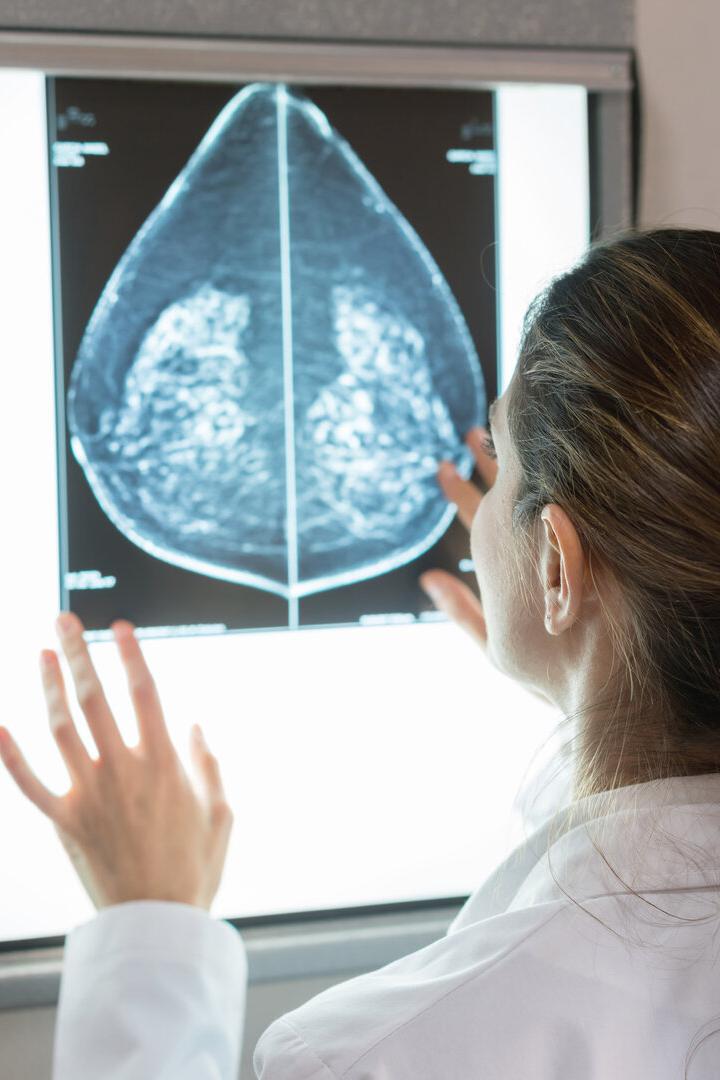 Frau begutachtet Bilder einer Mammografie.