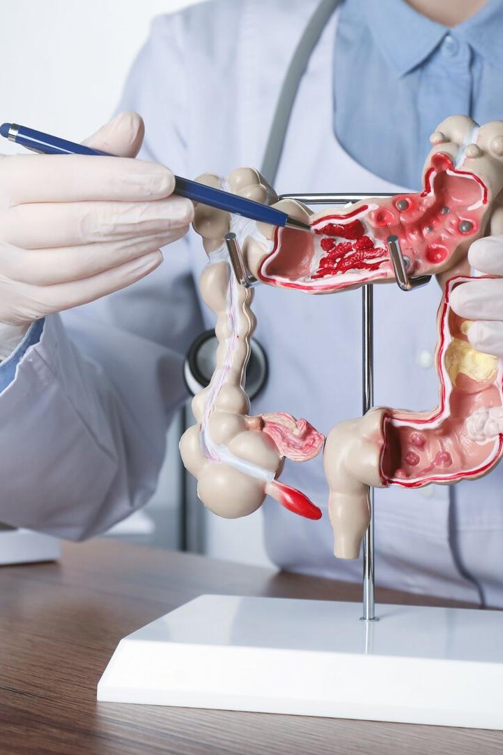 Eine Person mit Handschuhen zeigt mit einem Stift auf ein anatomisches Modell des menschlichen Darms.