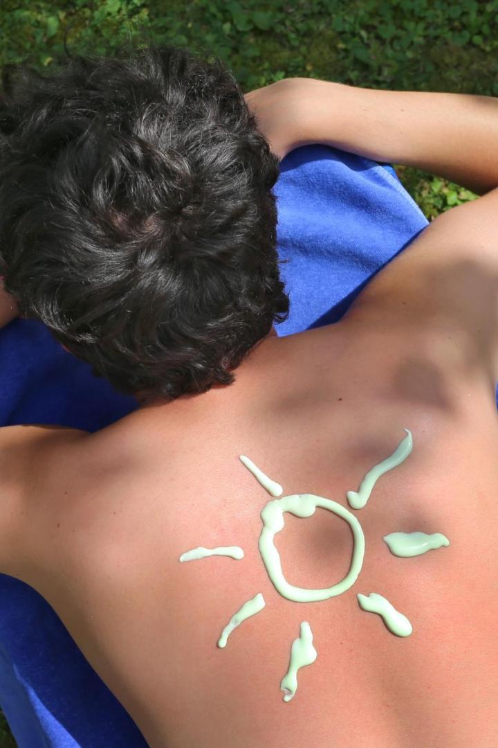 Sonnenbrand: Welche Hausmittel wirklich wirken