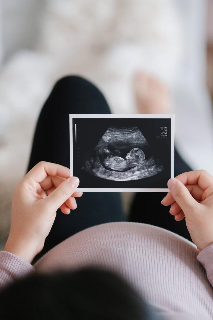 Eine schwangere Person hält ein Ultraschallbild mit einem erkennbaren Fötus in beiden Händen vor ihrem Bauch.