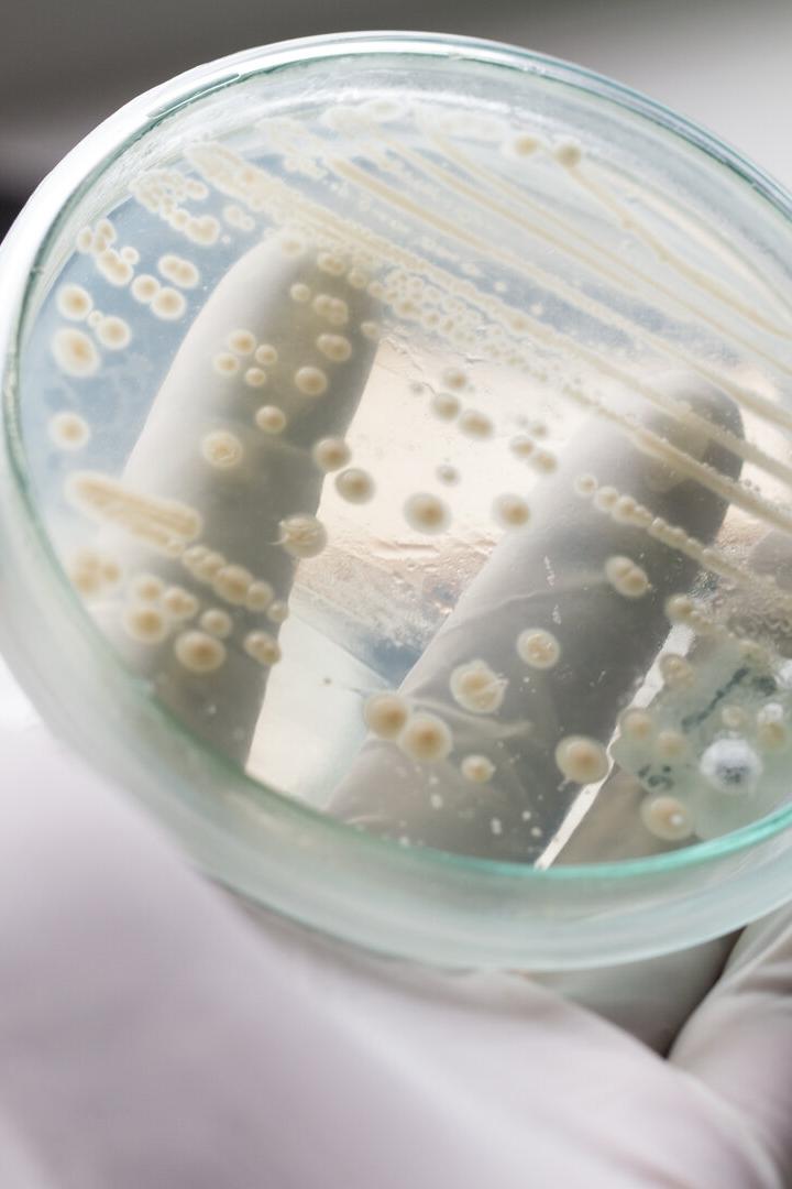 Das Foto zeigt eine Petri-Schale mit einer Kultur von Hefebakterien. Diese Bakterien sollen Proteine für die Herstellung von Arzneien und Lebensmittel produzieren. 