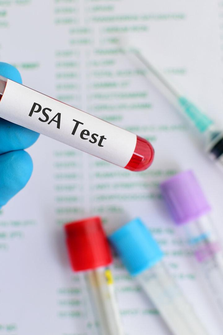 Blutröhrchen mit PSA test