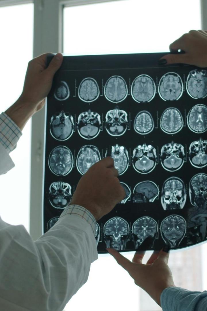 Zwei Ärzte, die gemeinsam einen MRT-Scan des Gehirns untersuchen.