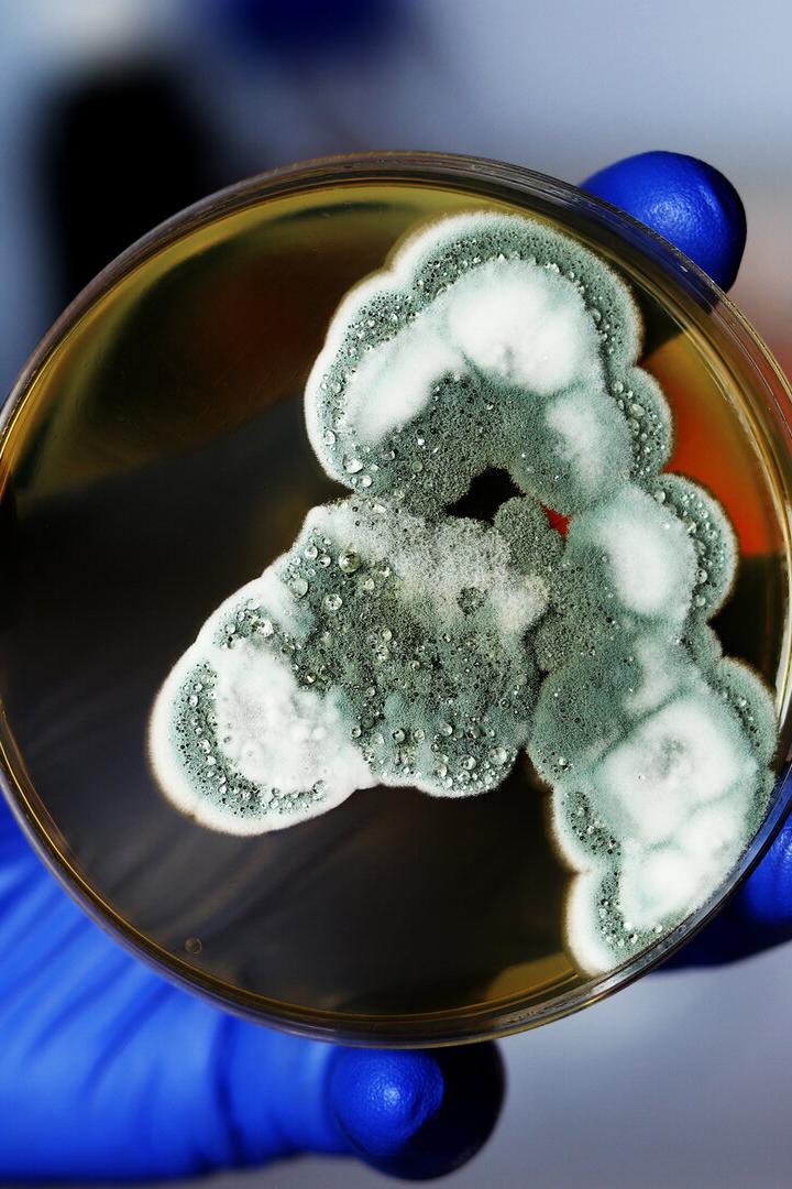 Eine Hand mit blauem Handschuh hält eine Petrischale mit grün-weißem Schimmelpilz.