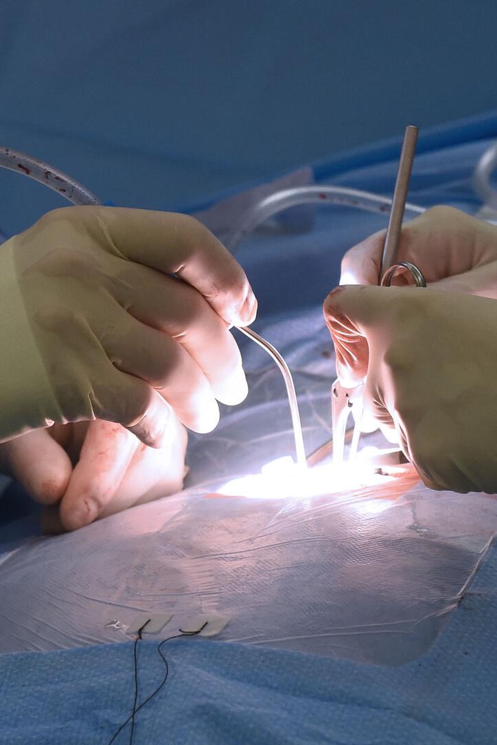 Ein Chirurg operiert mit Handschuhen und Instrumenten unter hellem Licht.