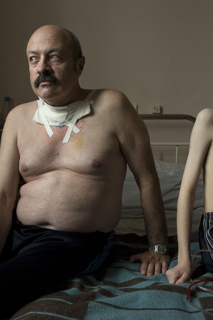 Ein Mann mit Schnurrbart und ein Junge sitzen mit Verbänden am Hals auf einem Bett.