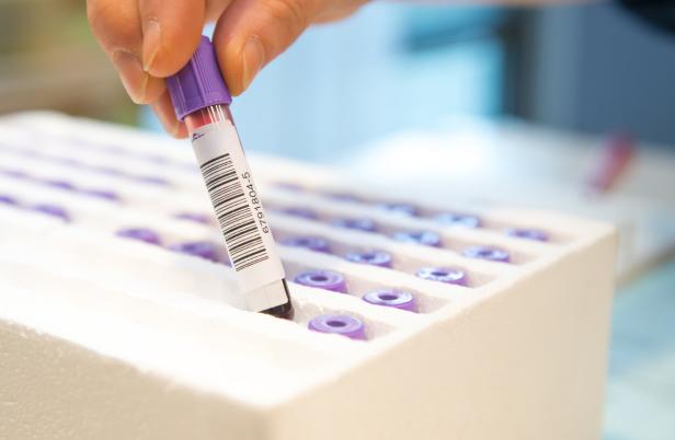 Eine Hand setzt ein Blutröhrchen mit lila Verschluss in einen Behälter.