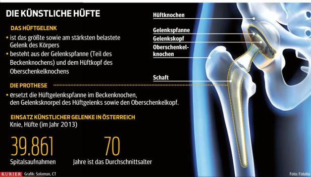 Zufrieden mit der neuen Hüfte