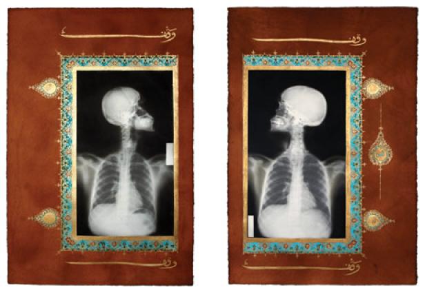 Zwei Röntgenbilder eines menschlichen Schädels und Oberkörpers, gerahmt in dekorativer islamischer Kunst.