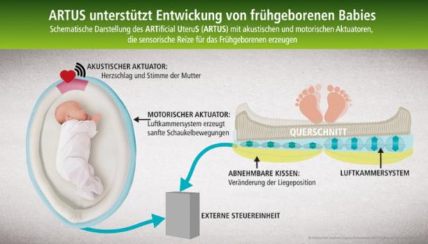 Künstliche Gebärmutter für Frühchen