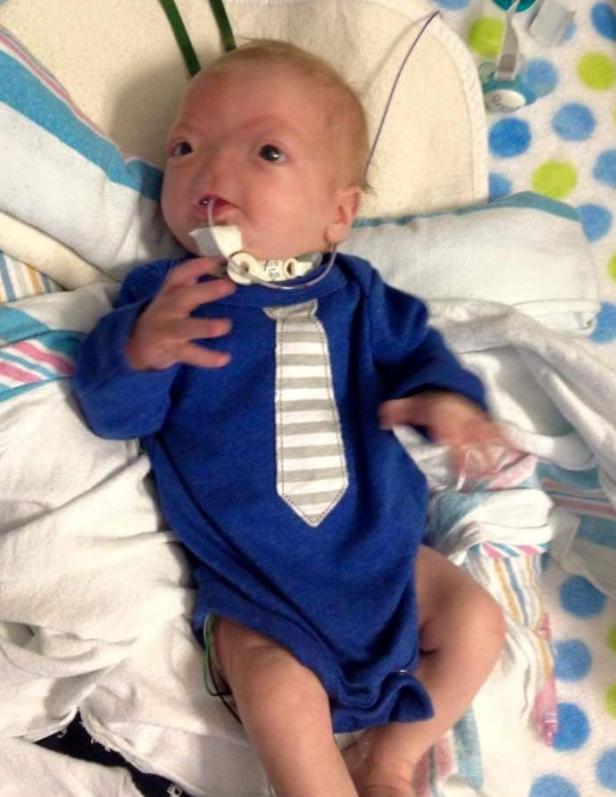 Ein Baby mit medizinischer Ausrüstung liegt in einem blauen Strampler mit Krawattenaufdruck auf einer Decke.