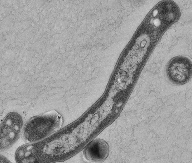 Neues Wissen über Tuberkulose durch alte Mumien