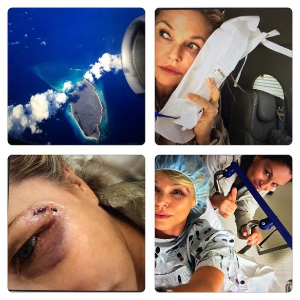 Ein Collage-Bild zeigt eine Frau vor und nach einer Augenverletzung, einschließlich eines Flugzeugblicks über eine Insel.