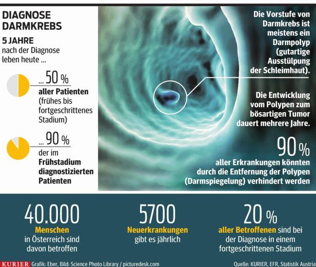 Darmkrebs: "Unser Ziel heißt heute Heilung"
