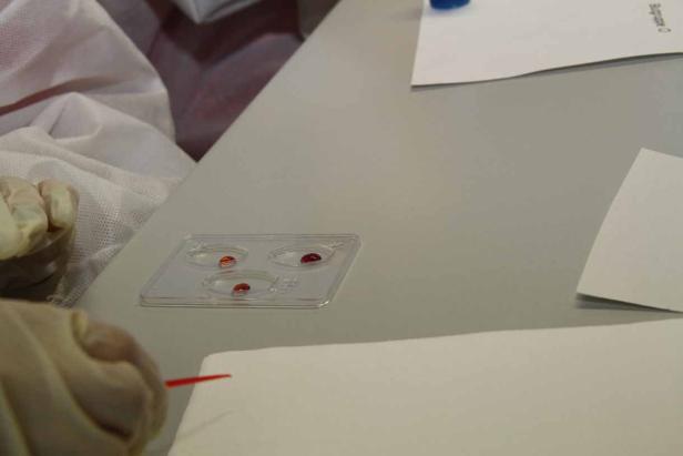 Ein Labortechniker führt einen Blutgruppentest durch.