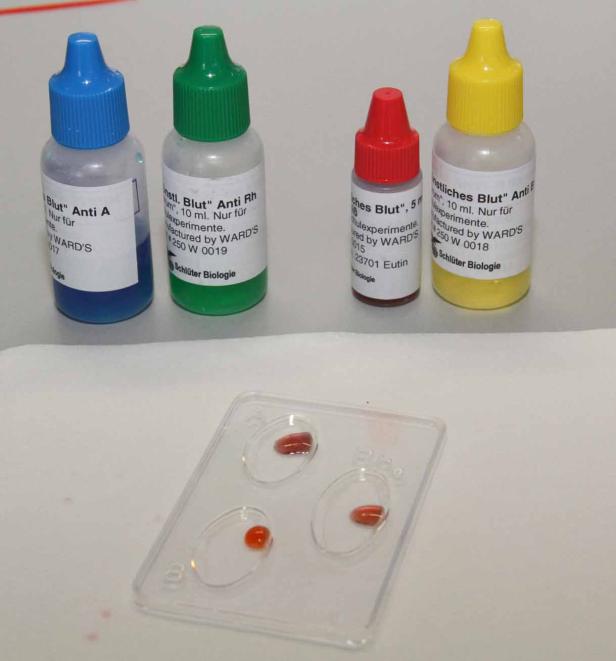 Reagenzien zur Bestimmung der Blutgruppe A, B und Rhesusfaktor stehen bereit.