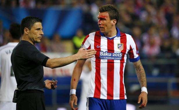 Ein blutender Fußballspieler wird von einem Schiedsrichter berührt.