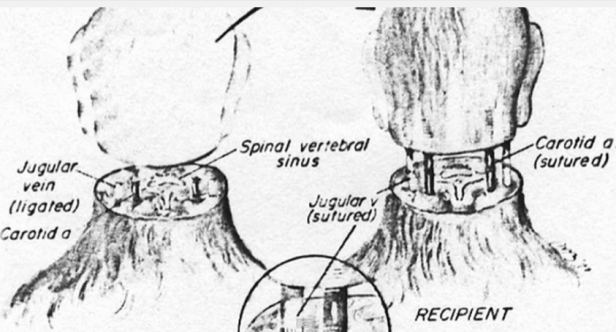 Eine schematische Darstellung einer Kopf-Transplantation mit beschrifteten Blutgefäßen.