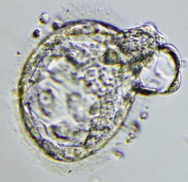 An early-stage cloned embryo called a blastocysts Ein Blastozyst, ein frühes Stadium der Embryonalentwicklung, unter dem Mikroskop.