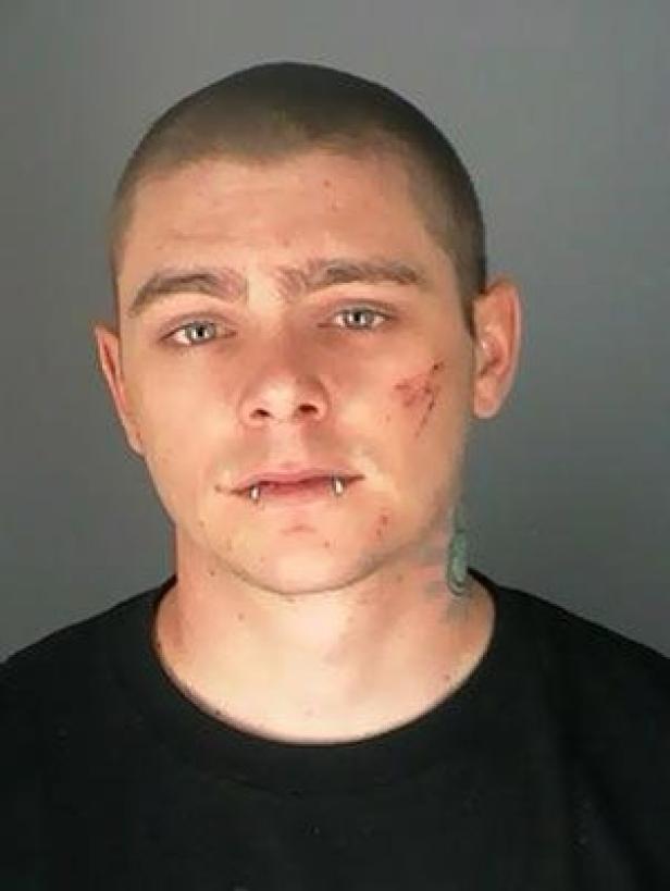Ein Mann mit kurzem Haar, Lippenschmuck, einer Tätowierung am Hals und einer Wunde im Gesicht.