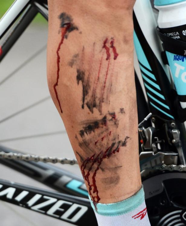 Das Bein eines Radfahrers ist nach einem Sturz aufgeschürft und blutet.