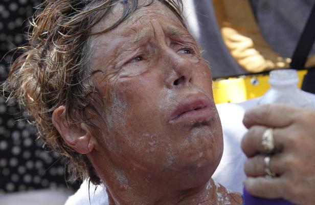 Das Gesicht einer Frau ist mit einer weißen Substanz bedeckt, möglicherweise Sonnencreme oder eine medizinische Creme.