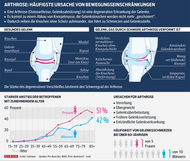 Gelenksprobleme: Schmerzen lindern ohne Schmerzmittel