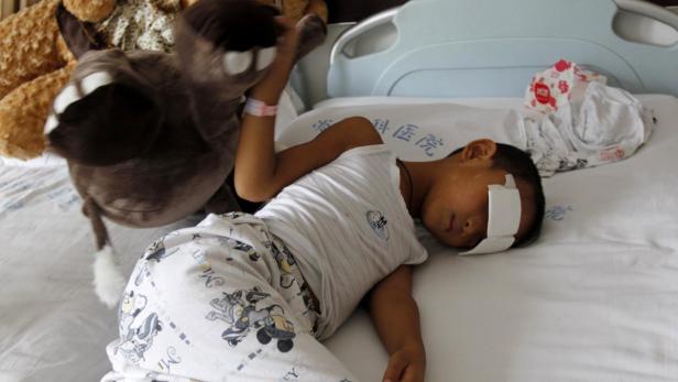 Six-year-old boy whose eyes were gouged out plays Ein Junge mit einem Verband auf der Stirn liegt mit einem Stofftier im Krankenhausbett.