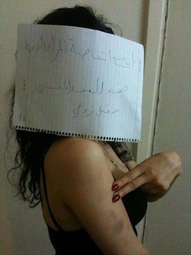 Eine Frau hält ein Schild mit arabischer Schrift vor ihr Gesicht, blaue Flecken sind auf ihrem Arm sichtbar.