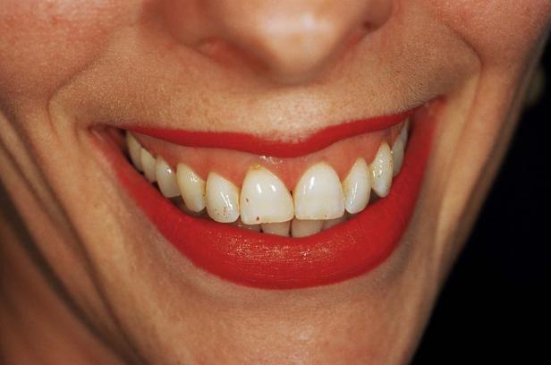 Nahaufnahme eines Lächelns mit roten Lippen und Zähnen.