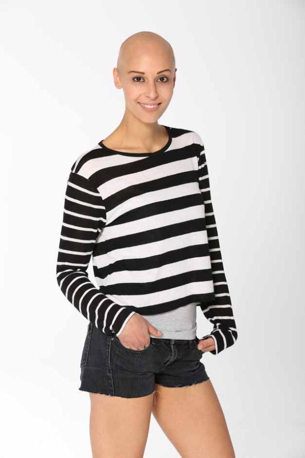 Eine Frau mit rasiertem Kopf trägt ein gestreiftes Oberteil und Jeansshorts.