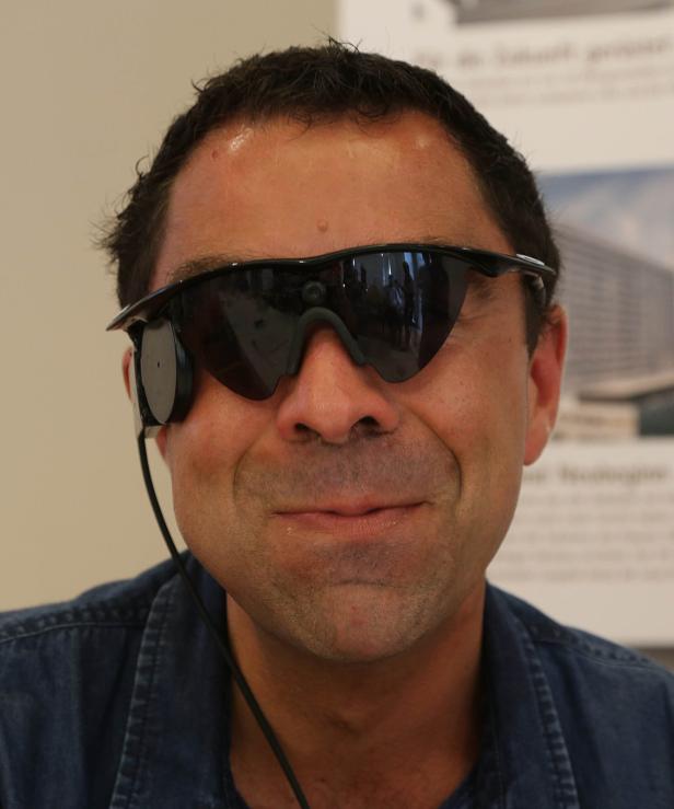 Erblindete Wienerin bekam bionisches Auge