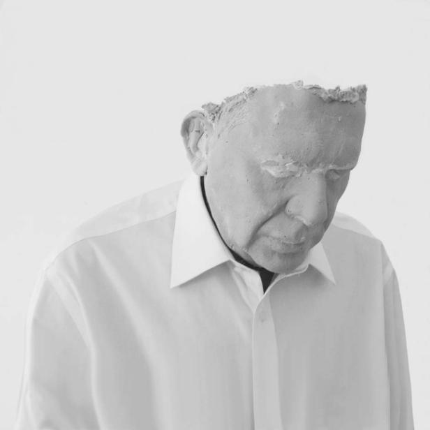 Ein Mann mit einer Gipsmaske auf dem Gesicht blickt nach unten.