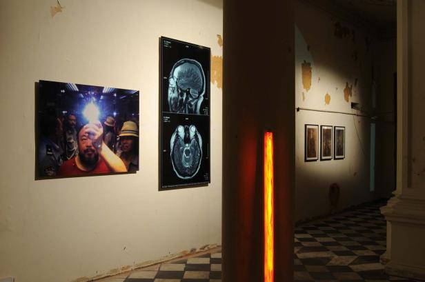 In einer Galerie hängen ein Selbstporträt von Ai Weiwei, MRT-Scans und weitere Bilder.
