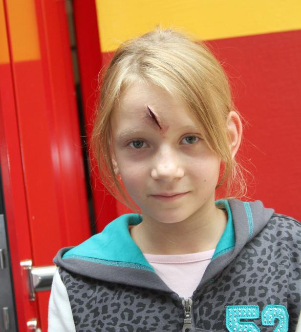 Ein Mädchen mit einer Schnittwunde auf der Stirn blickt in die Kamera.