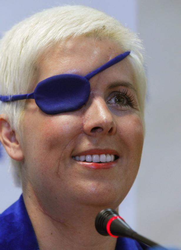 Eine Frau mit blonden Haaren und einer blauen Augenklappe lächelt in ein Mikrofon.
