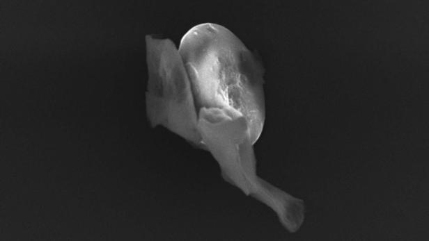 SPACE ALIEN LIFE Eine Nahaufnahme eines menschlichen Schulterblatts auf dunklem Hintergrund.