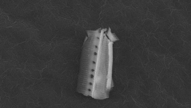 SPACE ALIEN LIFE Ein vergrößertes Bild einer einzelnen Kieselalge auf dunklem Grund.