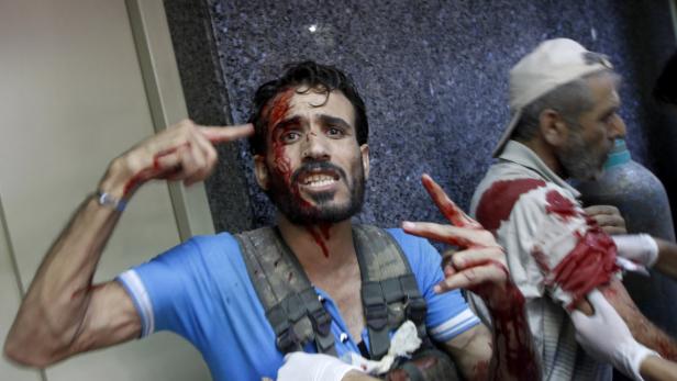 Ein Mann mit blutendem Gesicht gestikuliert, während ein anderer Mann im Hintergrund eine Sauerstoffflasche hält.