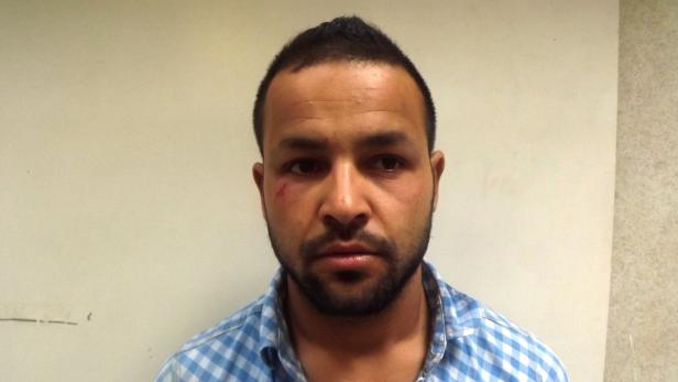 Ein Mann mit Bart und einer Schramme im Gesicht schaut in die Kamera.