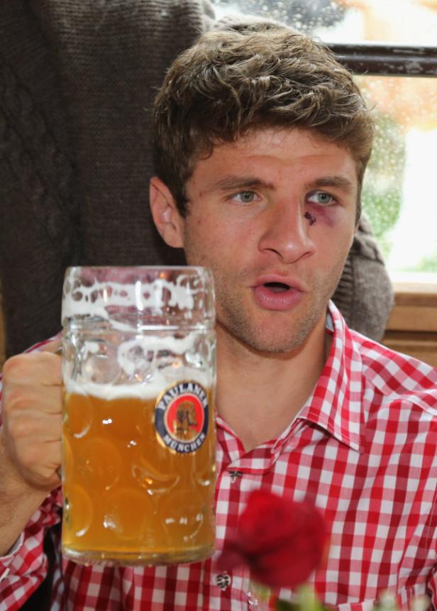 Thomas Müller mit einem Veilchen unter dem Auge hält einen Maßkrug Bier.