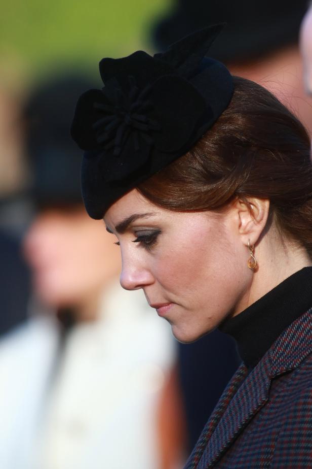 Prinz William steht jetzt zu seiner Glatze