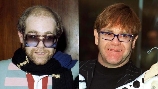 Elton John & Co: Will Haare!